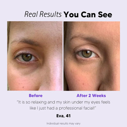 EyeBeauty Glasses
