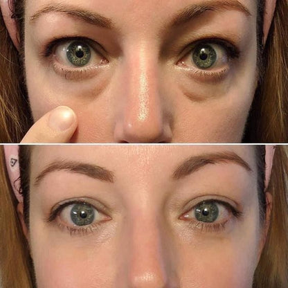 EyeBeauty Glasses